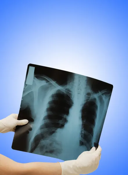 Twee handen met x-ray afbeelding van menselijk lichaam — Stockfoto