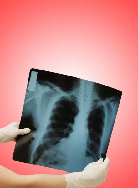 Két kéz tartja a röntgen kép az emberi test — Stock Fotó