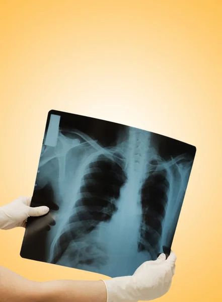 Két kéz tartja a röntgen kép az emberi test — Stock Fotó