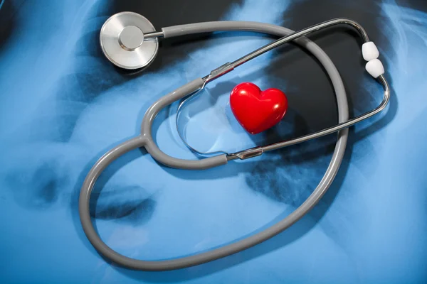 stock image Stethoscope and heart on X-ray