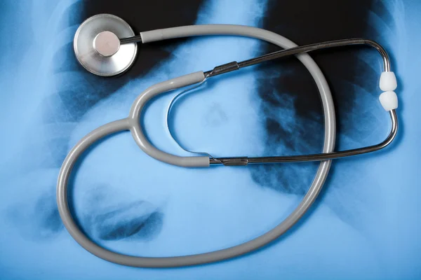 stock image Stethoscope on X-ray