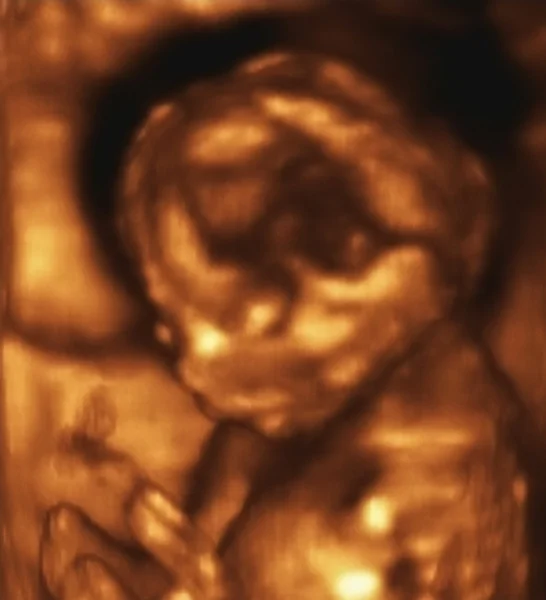Análisis ultrasonográfico de un feto de cuarto mes — Foto de Stock