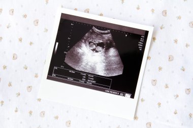Ultrasound image for pregnancy clipart