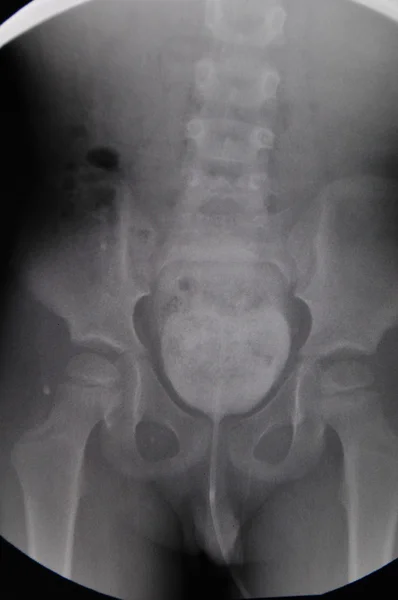 Břicho x ray — Stock fotografie