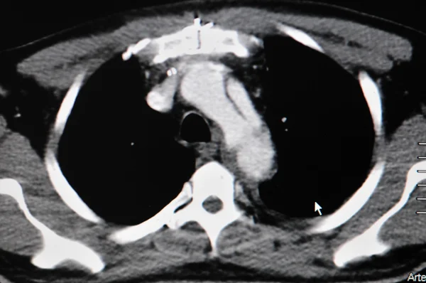 Akciğer ct — Stok fotoğraf