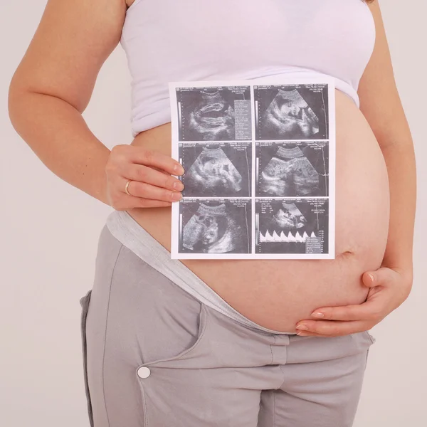 Беременная женщина с ультразвуковым изображением — стоковое фото