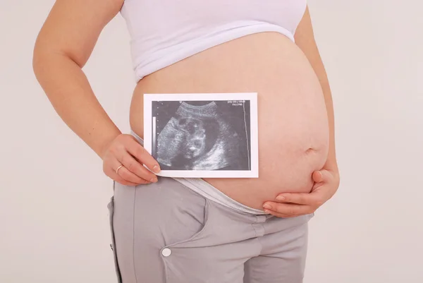 Pregnant woman holding ultrasound image — Stock Photo, Image