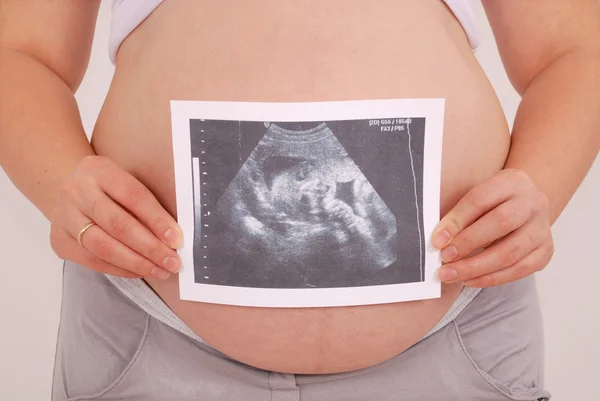 Pregnant woman holding ultrasound image — Stock Photo, Image