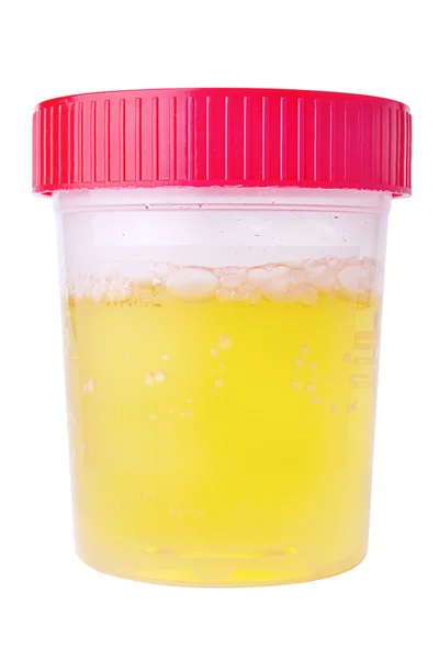 Échantillon d'urine — Photo