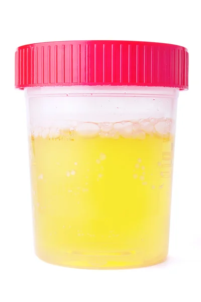 Urine Sample — Stock Photo, Image