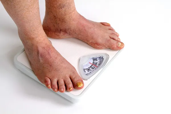 Old Feet On Scale — Stock Photo, Image