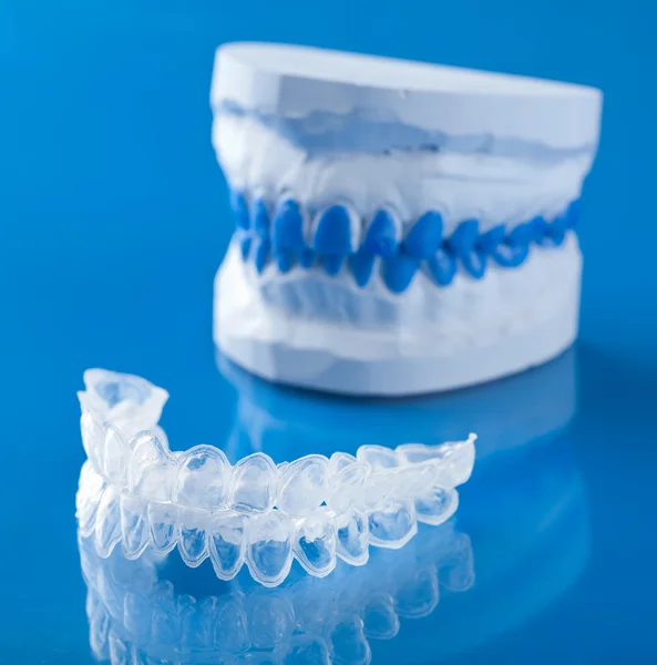 Jednotlivé zuby zásobník pro bělení — Stock fotografie