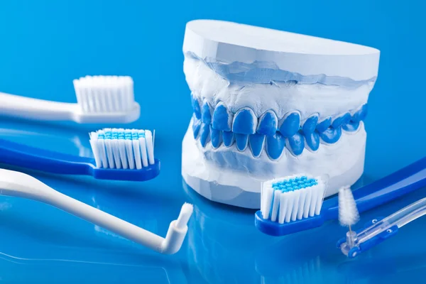 Moldes dentales de yeso individuales y cepillos de dientes —  Fotos de Stock