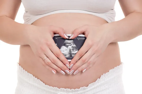 Embarazada con foto de su ultrasonido — Foto de Stock