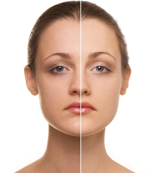 Correcção facial da mulher — Fotografia de Stock