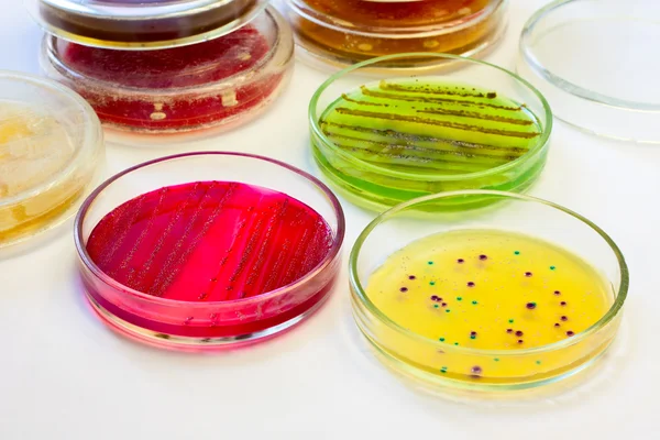 Płytki Petriego z kolonii bakteryjnych Zdjęcia Stockowe bez tantiem