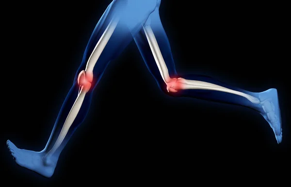 Dolor en las articulaciones de la rodilla — Foto de Stock