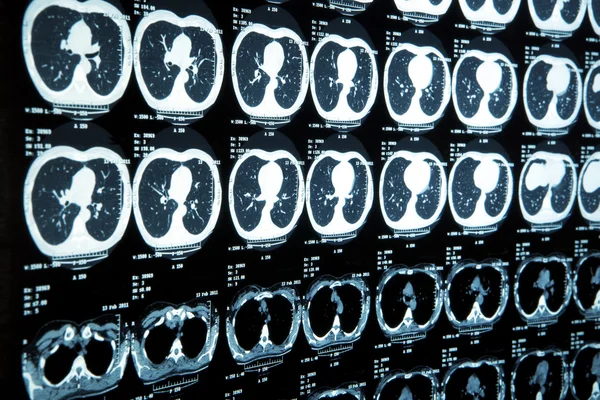 MRI mózgu człowieka — Zdjęcie stockowe