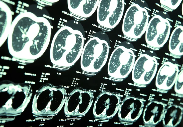 Az emberi agy MRI — Stock Fotó