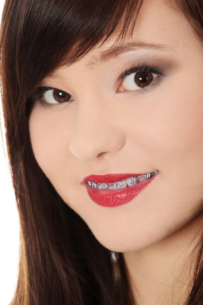 Sorrindo mulher adolescente com dispositivo de correção nos dentes — Fotografia de Stock