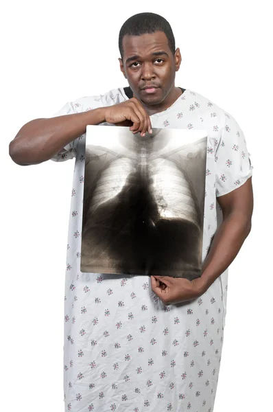 Homem negro Paciente — Fotografia de Stock