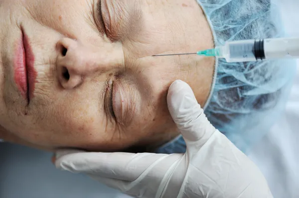 Senior woman getting on face injection at hospital — Stock Photo, Image