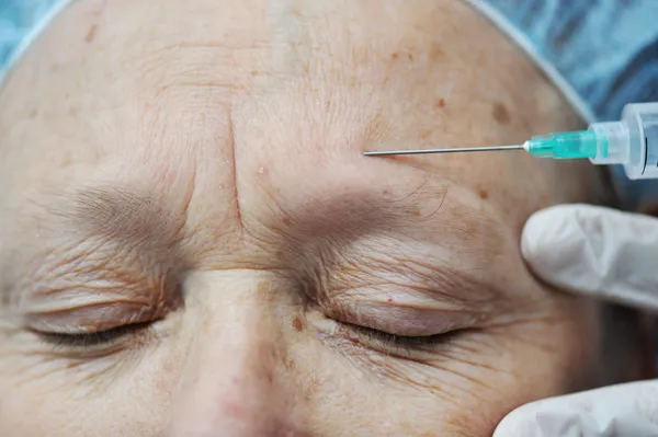 Aged female receiving botox injection in forehead — Stock Photo, Image