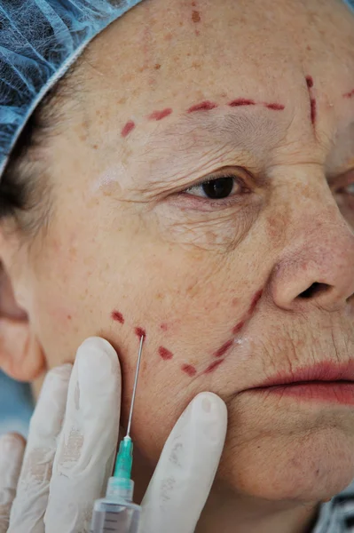 Ανώτερος γυναίκα να πάρει botox ένεση στο νοσοκομείο — Φωτογραφία Αρχείου