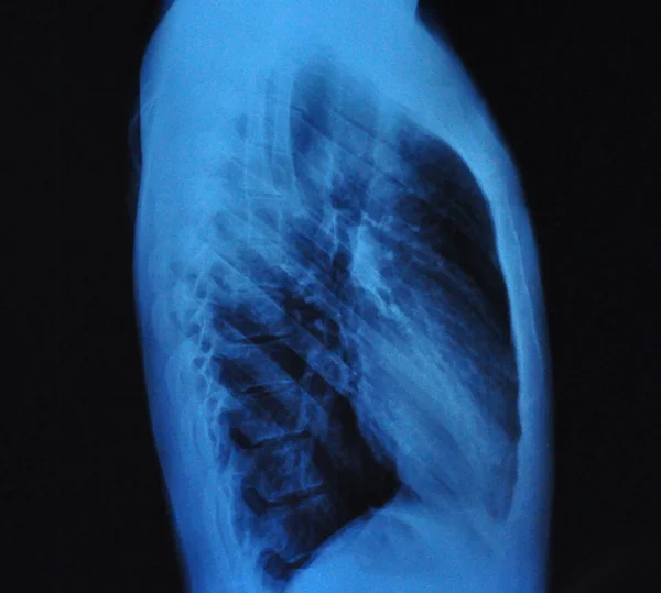 Mänskliga röntgen — Stockfoto
