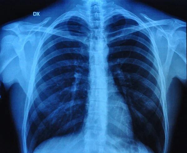 Menschliches Röntgenbild Stockbild