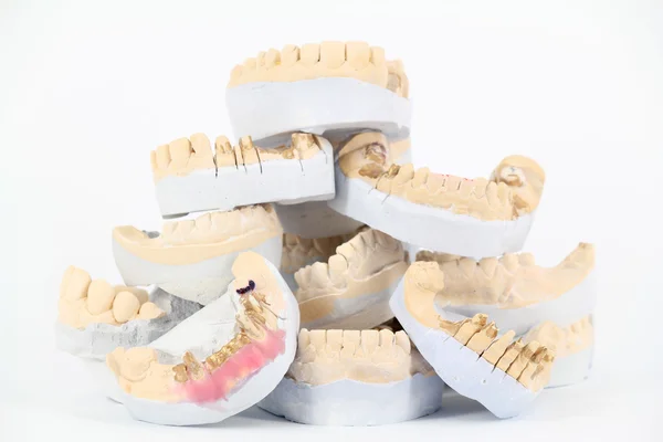 Modelo de yeso de dientes — Foto de Stock