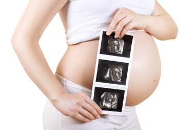 Pregnant woman holding ultrasound image clipart