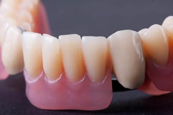 Модель зубного воска — стоковое фото