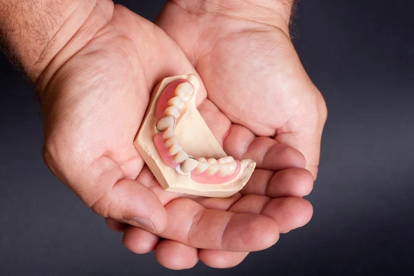 Zubní voskový model — Stock fotografie