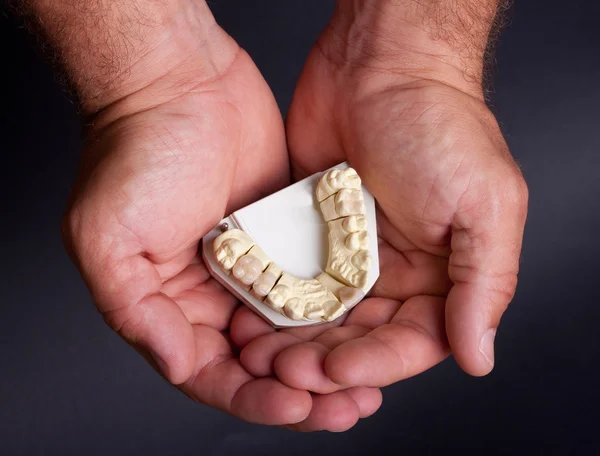 Modello di cera dentale — Foto Stock