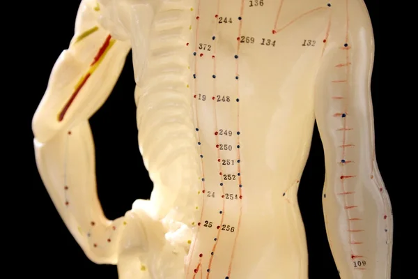 stock image Acupuncture figure back view