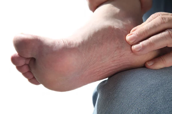 Fußschmerzen — Stockfoto