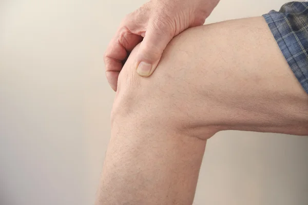 痛み膝 — ストック写真