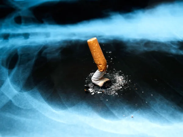 Questões relativas ao tabagismo — Fotografia de Stock