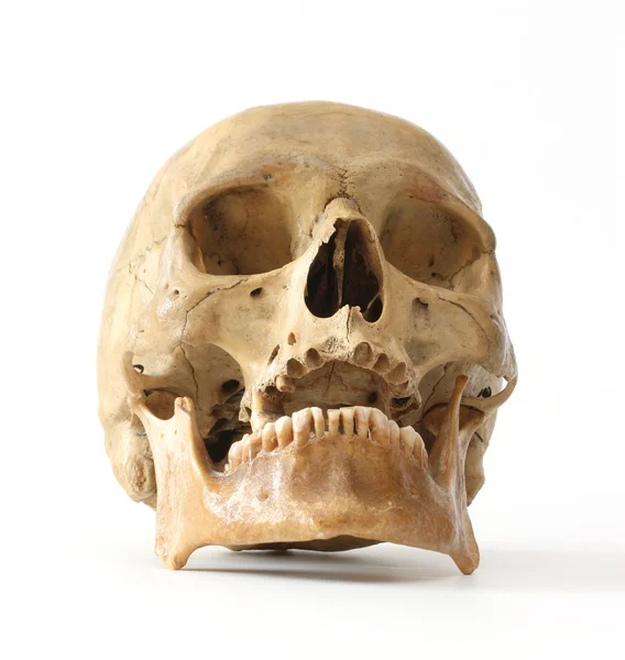 Crânio humano . — Fotografia de Stock