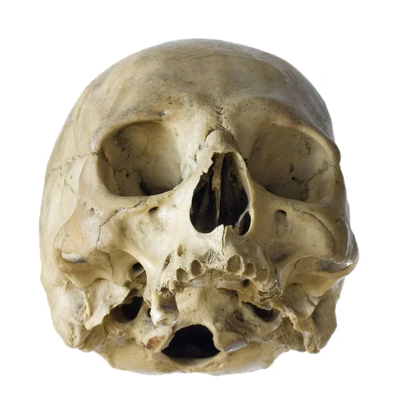 Crâne de la personne . — Photo