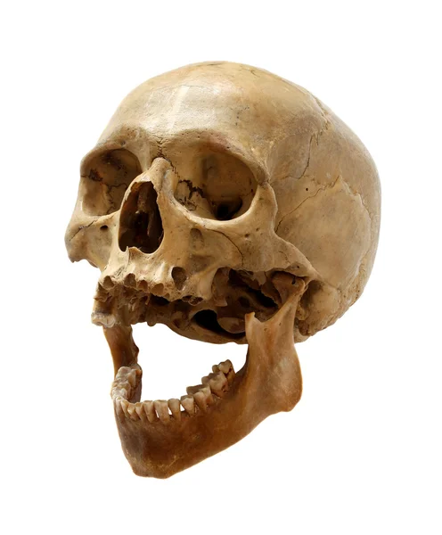 Skull of the person. Stock Photo