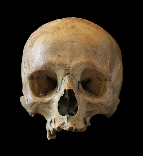人の頭蓋骨. — ストック写真