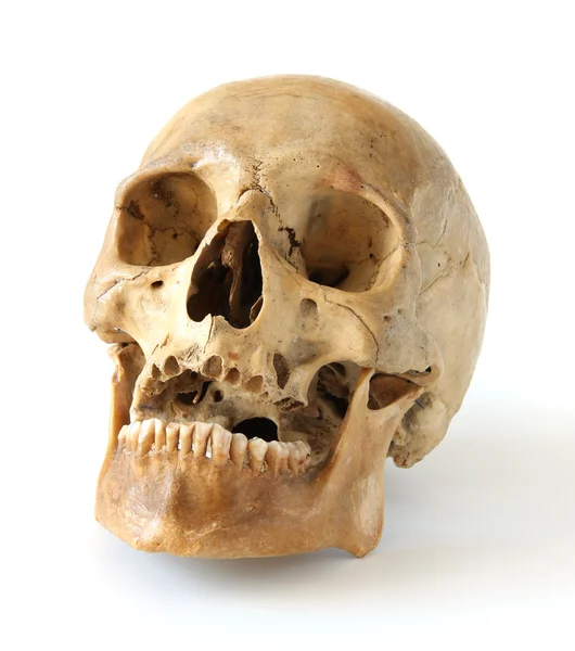Crânio humano . — Fotografia de Stock