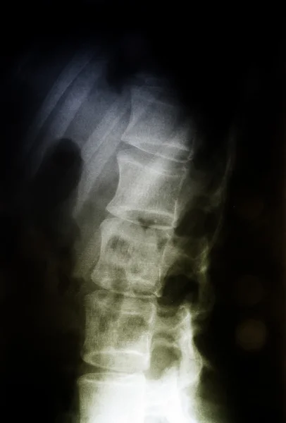 Radiografia — Foto Stock