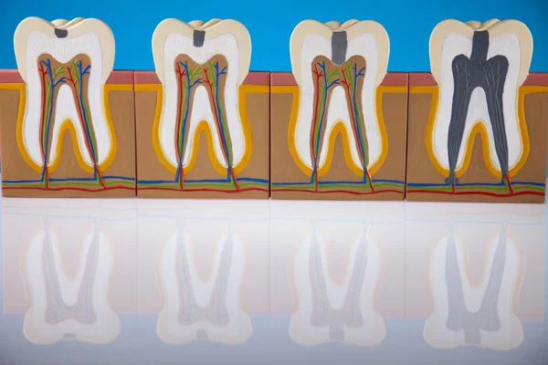 Tooth anatomy — Stock Photo, Image