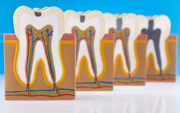 stock image Anatomy of the tooth