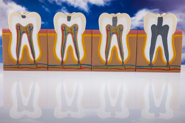 stock image Human tooth structure