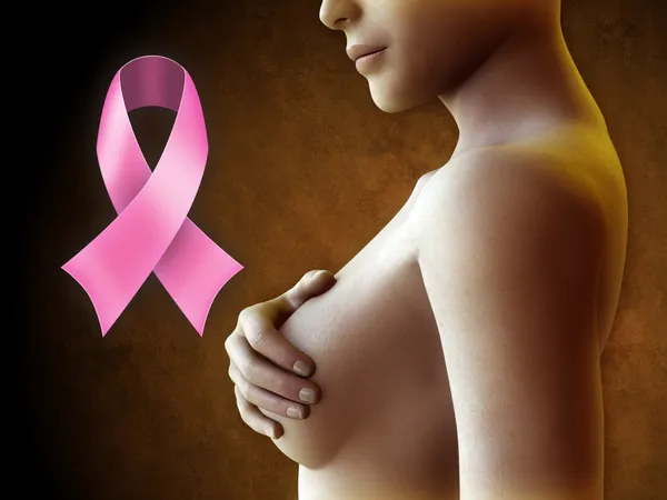 Cancro da mama — Fotografia de Stock