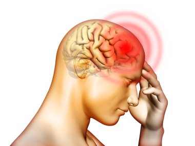 Headache clipart